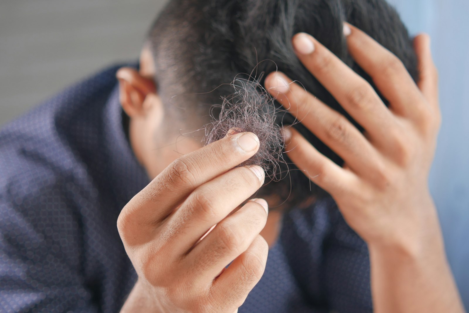 A man examining a clump of shed hair, concerned about hair fall